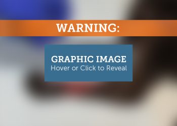 A Meaningful Foster Experience Leads to Adoption of a Once Injured and Abandoned Feline