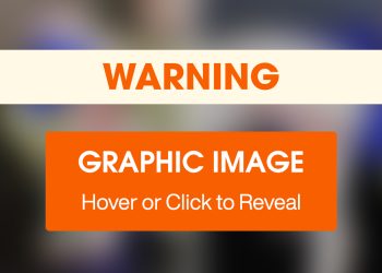 Chip’s Journey Captivates Many, Culminating in Adoption