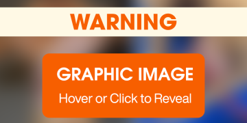 After Recovering From Injuries, This Sweet Dog Sealed the Deal With Her New Family