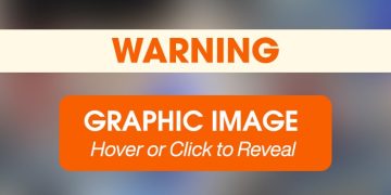 After Recovering from a Horrific Neck Wound, Potato Puts His Past Behind Him After Recovering from a Horrific Neck Wound, Potato Puts His Past Behind Him