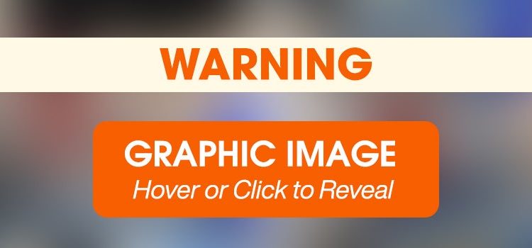 After Recovering from a Horrific Neck Wound, Potato Puts His Past Behind Him After Recovering from a Horrific Neck Wound, Potato Puts His Past Behind Him