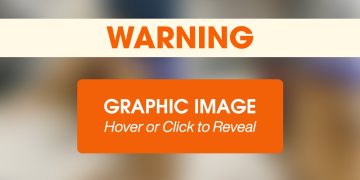 ASPCA Community Veterinary Clinic Helps Dog with Traumatic Ear Injury ASPCA Community Veterinary Clinic Helps Dog with Traumatic Ear Injury