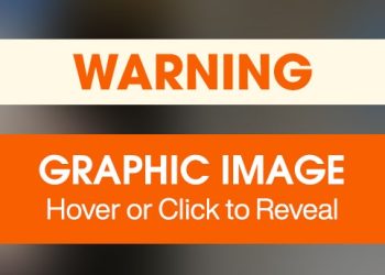 Healing and Hope: Brie’s Second Act