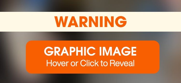 Healing and Hope: Brie’s Second Act Healing and Hope: Brie’s Second Act